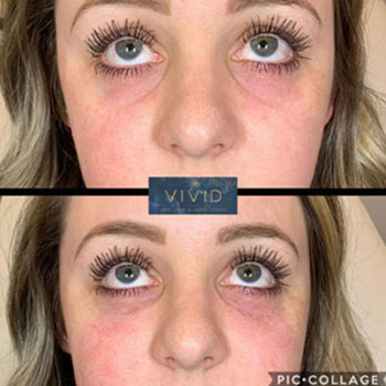 Vivid Skin Care - Medspaaz