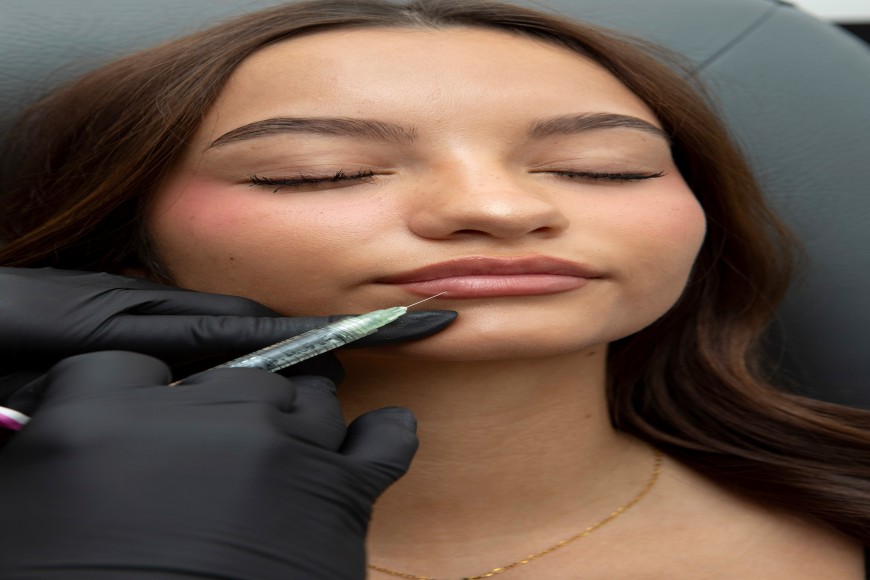 Latest lip filler trends