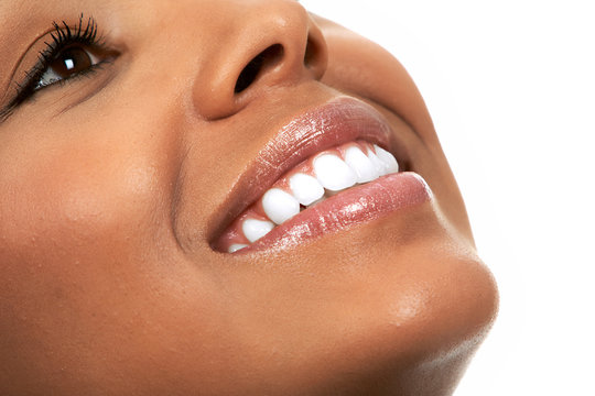 lady showing clean teeth