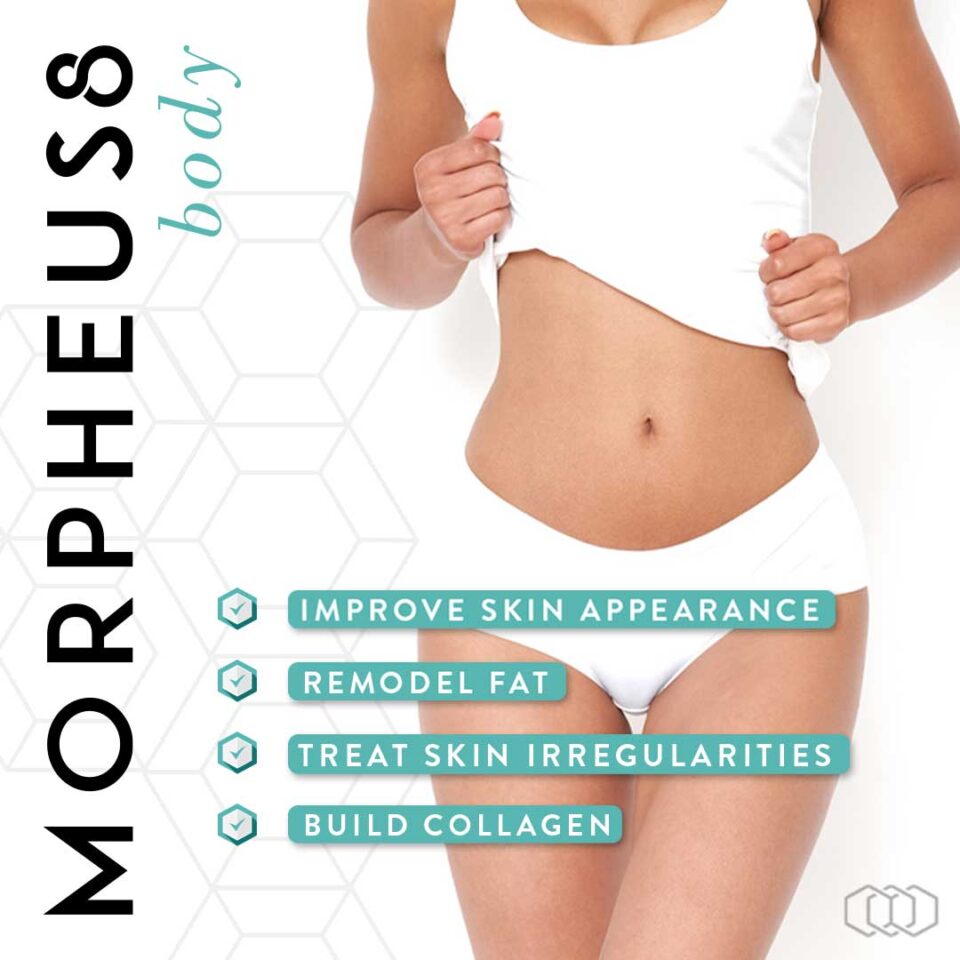 Morhpeus 8 skin treatment