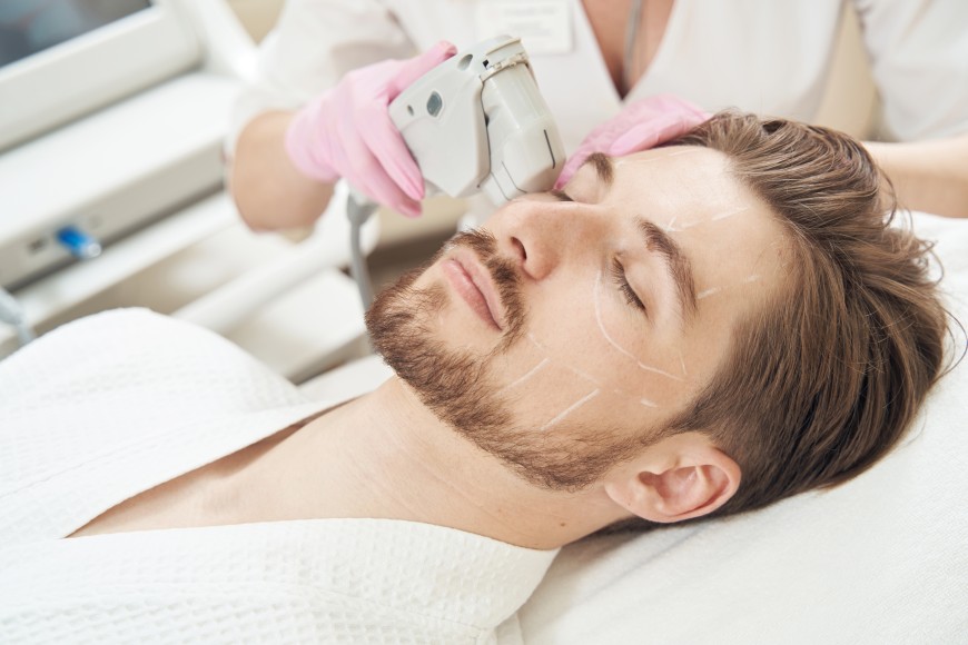 Overview of IPL Treatment for Men
