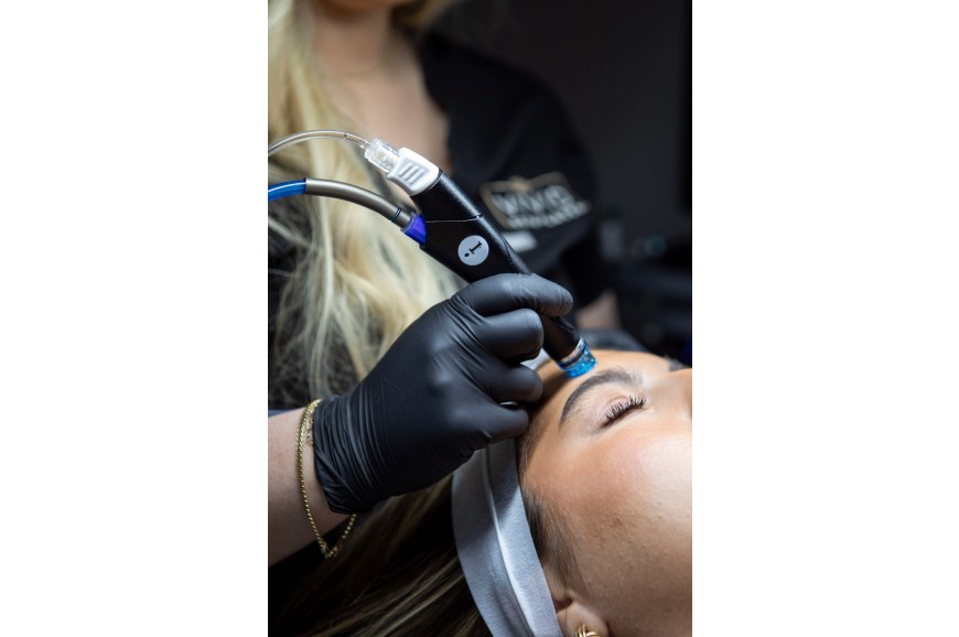 IPL photorejuvenation candidates