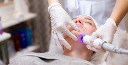 IPL photorejuvenation treatment