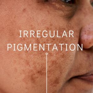 irregular pigmentation