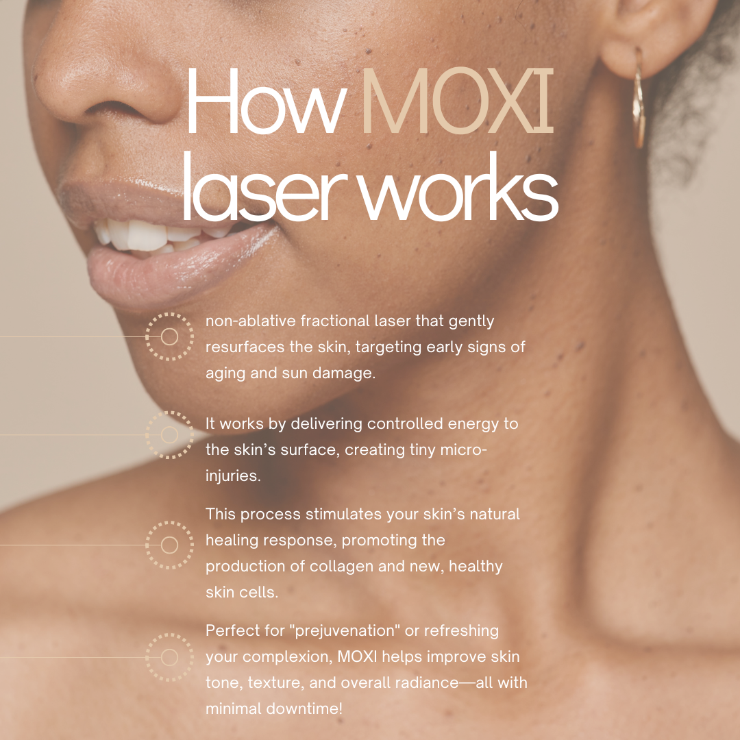 moxi laser