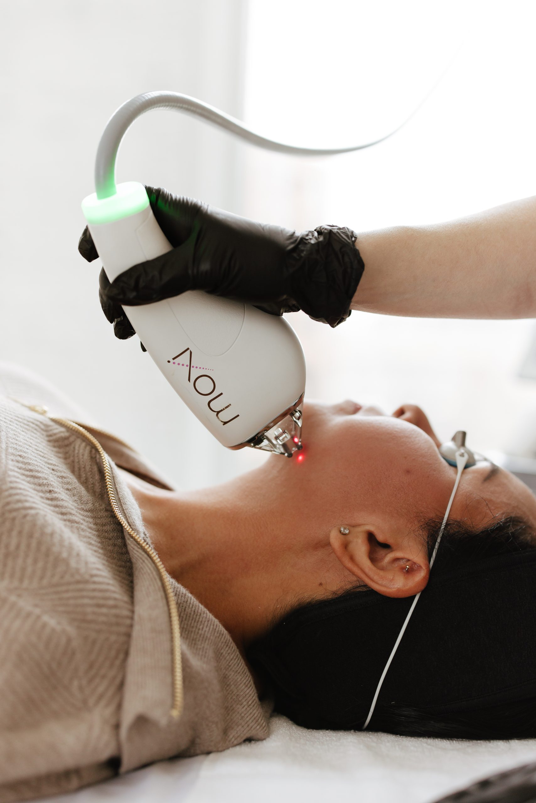 nano laser peel