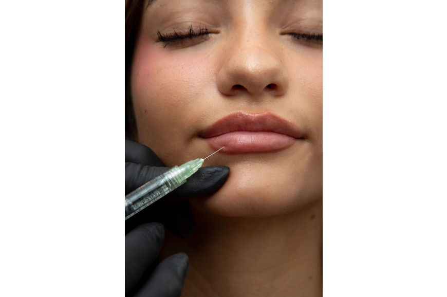 Botox or Fillers in Chandler