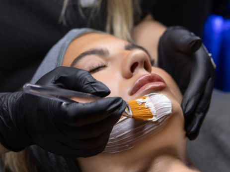 Acne Rescue Facial Treatment