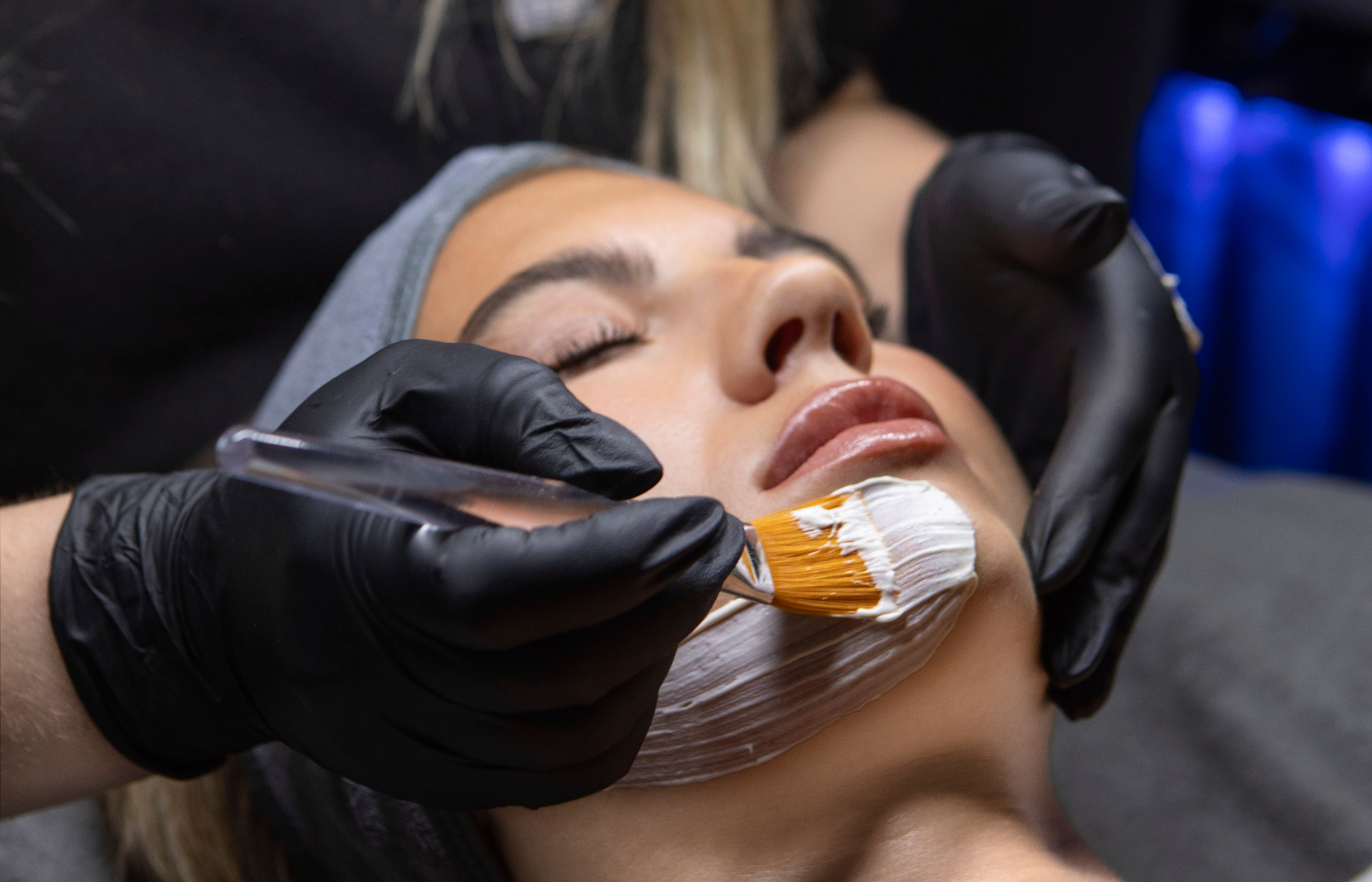 Acne Rescue Facial Treatment