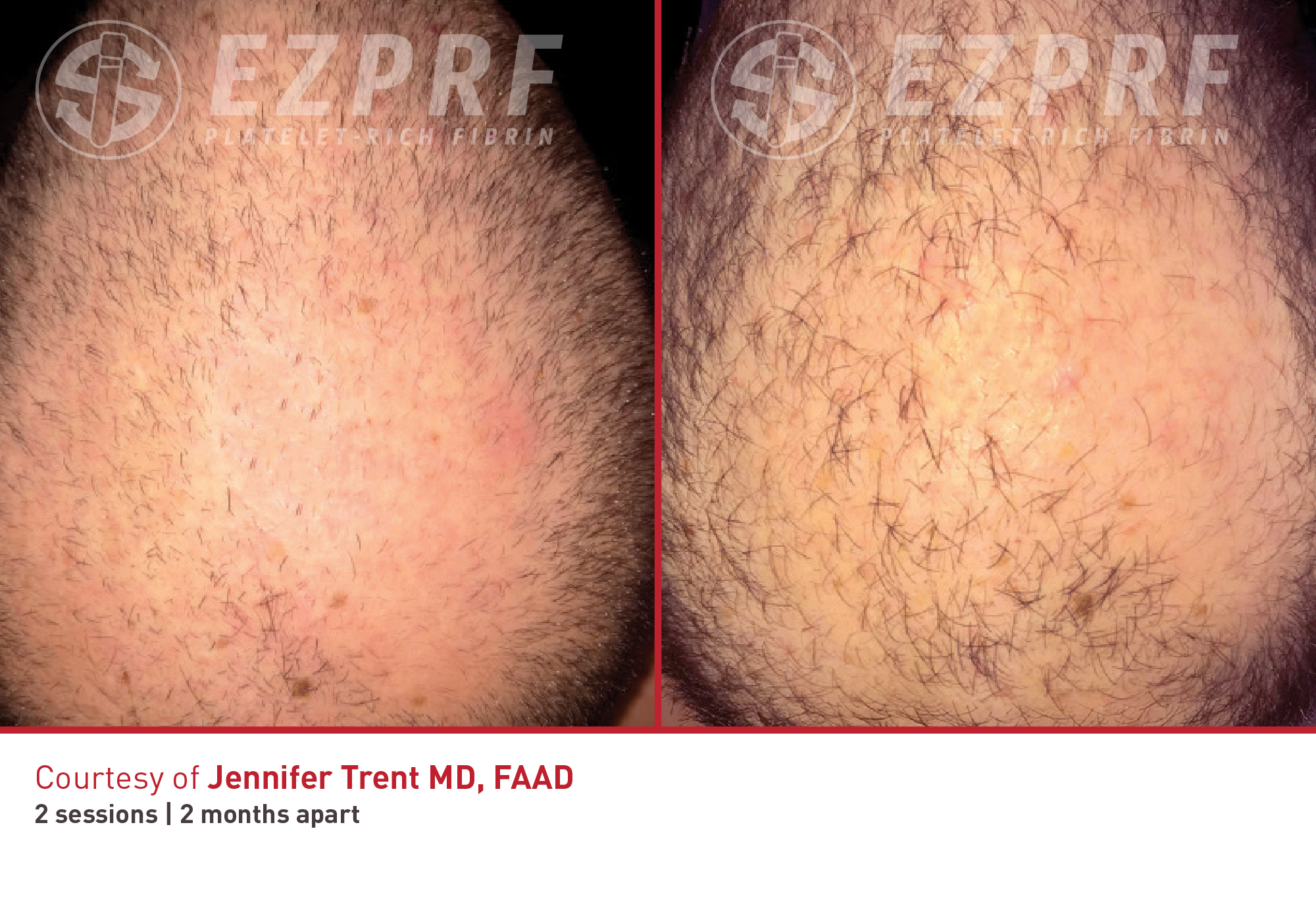 bna-ez-hair-1