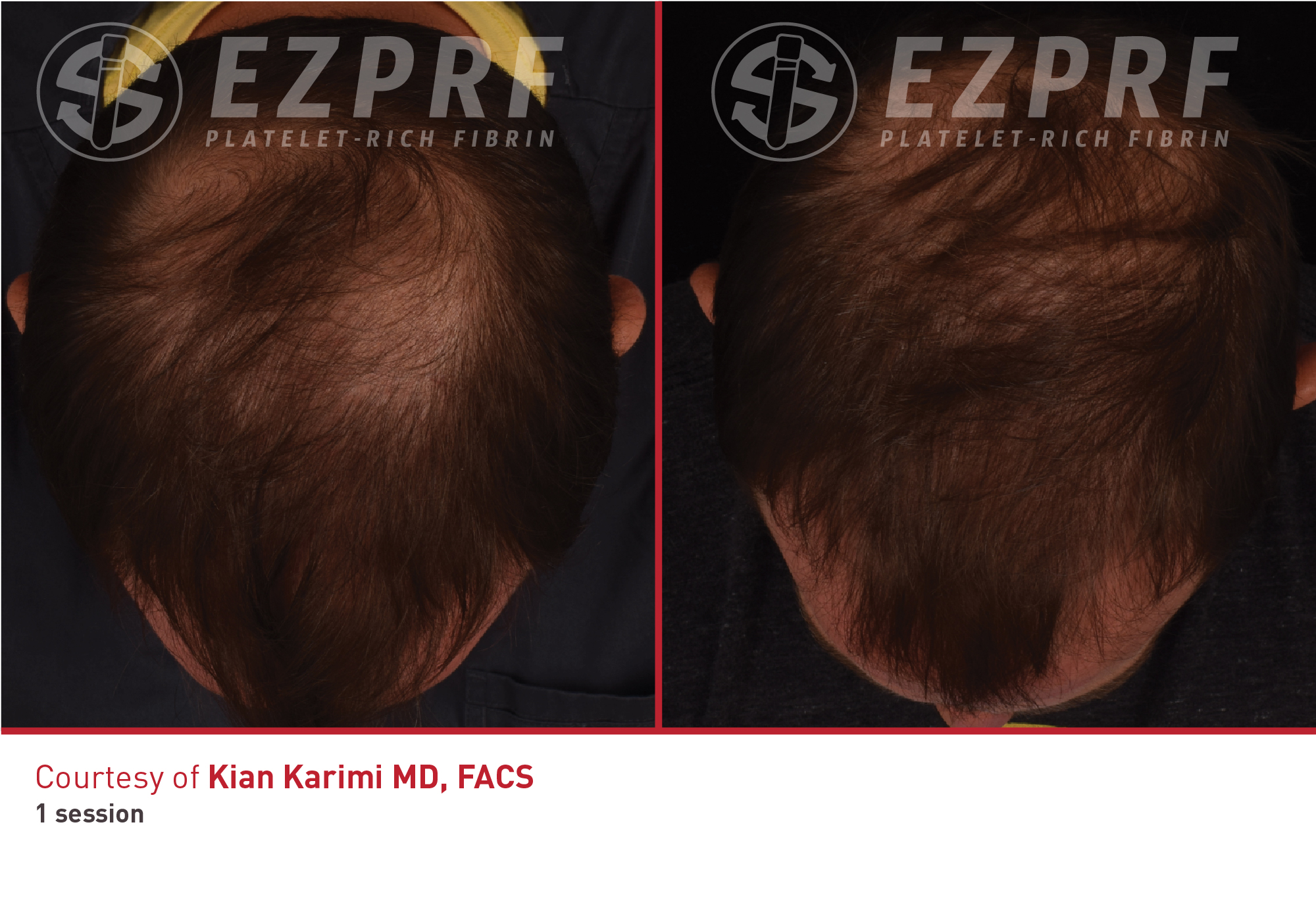 bna-ez-hair-3