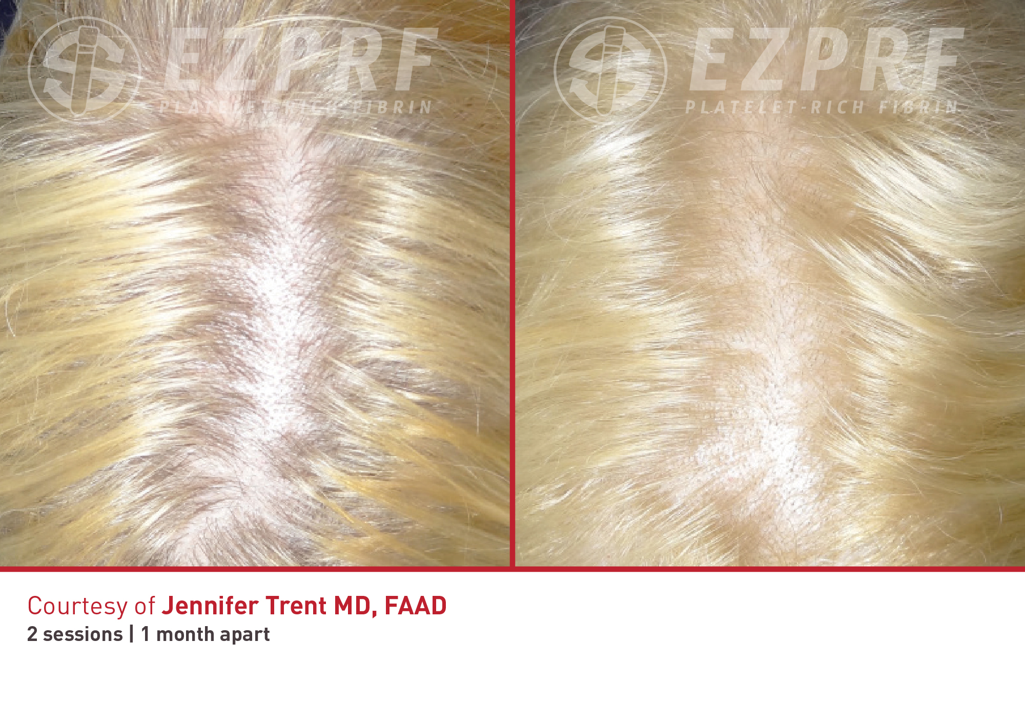 bna-ez-hair-4