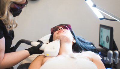 Laser Hair Removal