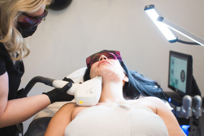 Laser Hair Removal