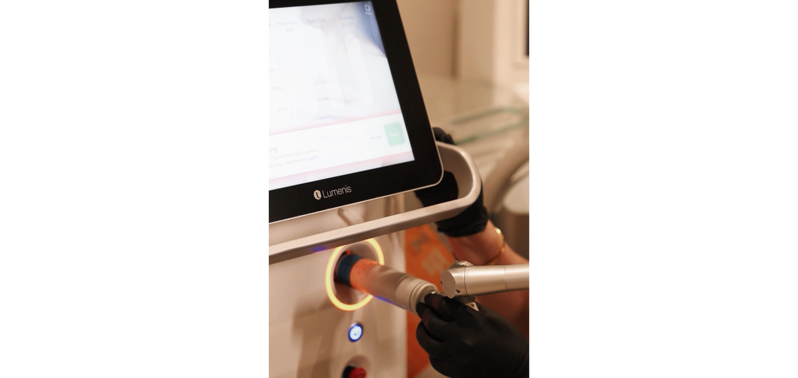 Tattoo Colors Laser Treatment
