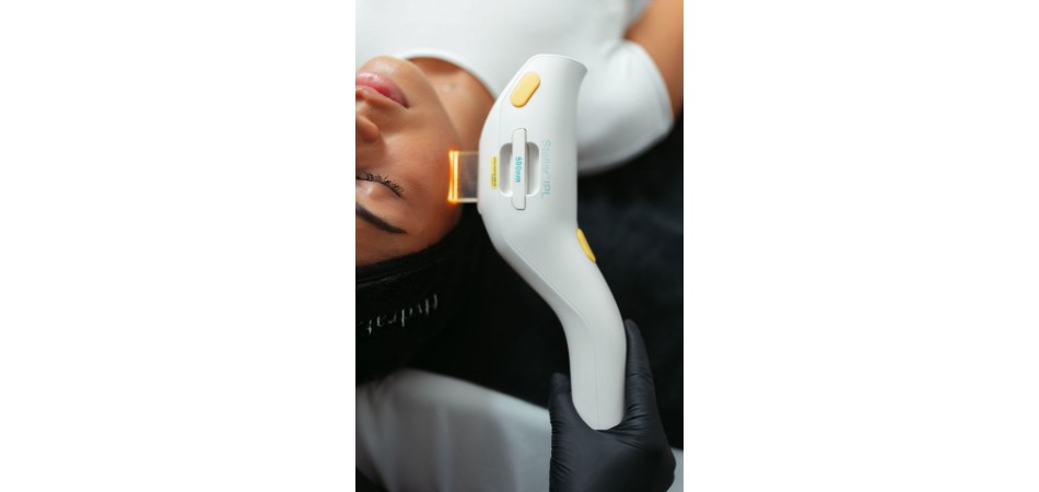 IPL Facial Treatments